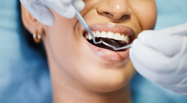 Best Broken or Cracked Tooth Emergency Dentist in Pueblo West, CO